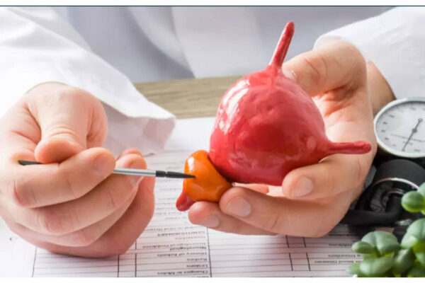 25% of men will have an enlarged prostate with 50: what can be done to prevent it