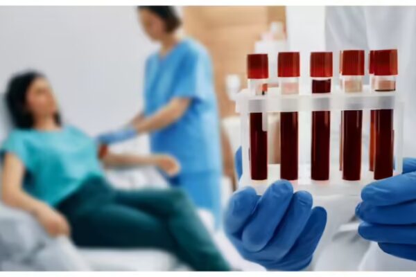 Leading Cardiologist Reveals 5 Essential Blood Tests That Could Save Your Life: “Don’t Spend 5 Years Overlooking This…”