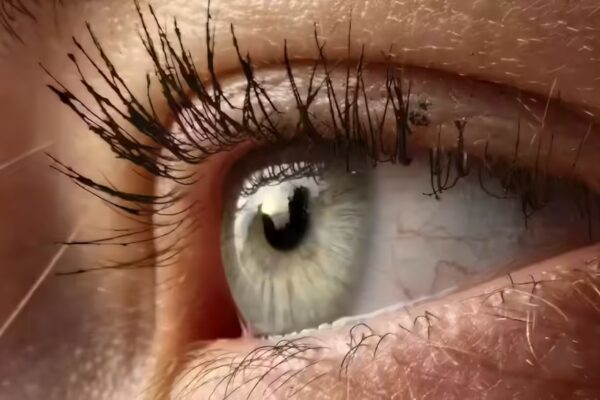 Tips for Protecting Your Eyes This Diwali: Insights from an Eye Surgeon